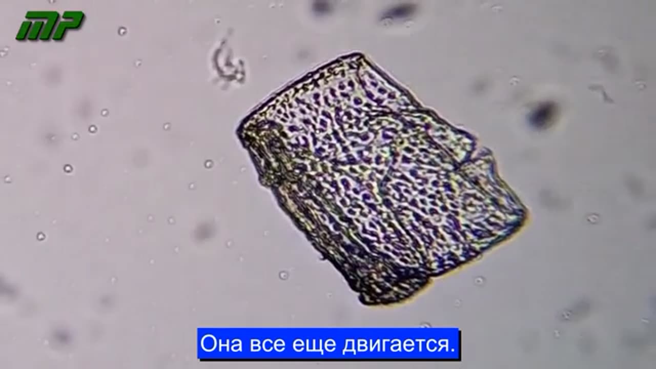 Анализ под микроскопом вакцины AstraZeneca, проведенный доктором Лилианой Селада Рюк.1