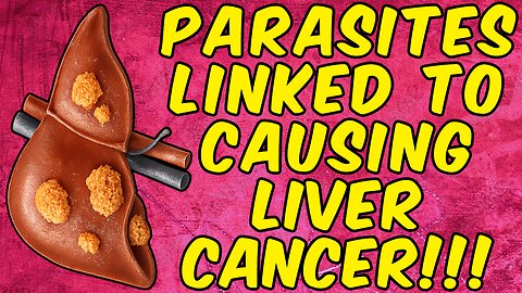 Parasites Linked To Causing Liver Cancer & Why! - (Science Based)
