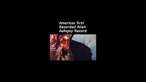 Autopsy of alien