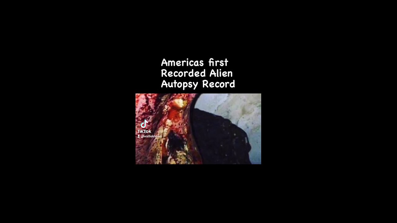 Autopsy of alien
