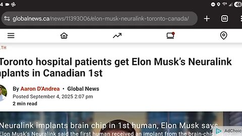 2 people receive Neuralink implant (MOTB) in Canada!
