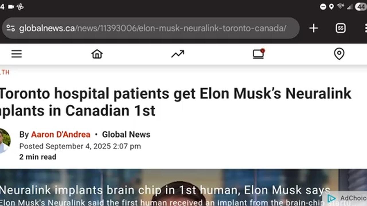 2 people receive Neuralink implant (MOTB) in Canada!