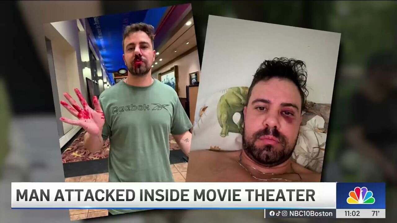 Black Fatigue: Harvard Researcher Beaten Bloody When Asking Loud Youths To Be Quiet At Movie Theatre