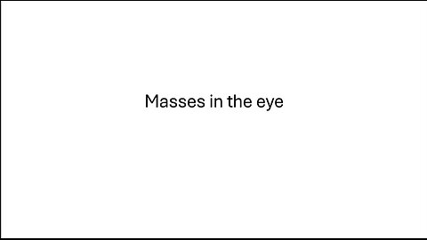 Ai Assimilation- Masses in the Eye