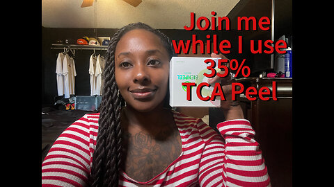 BienPeel 35% TCA Peel // NO DOWN TIME!!