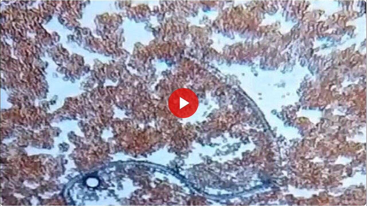 Analysis of a Single Drop of SINOPHARM "VACCINATED" BLOOD (LQC / Dr. Liliana Zelada)