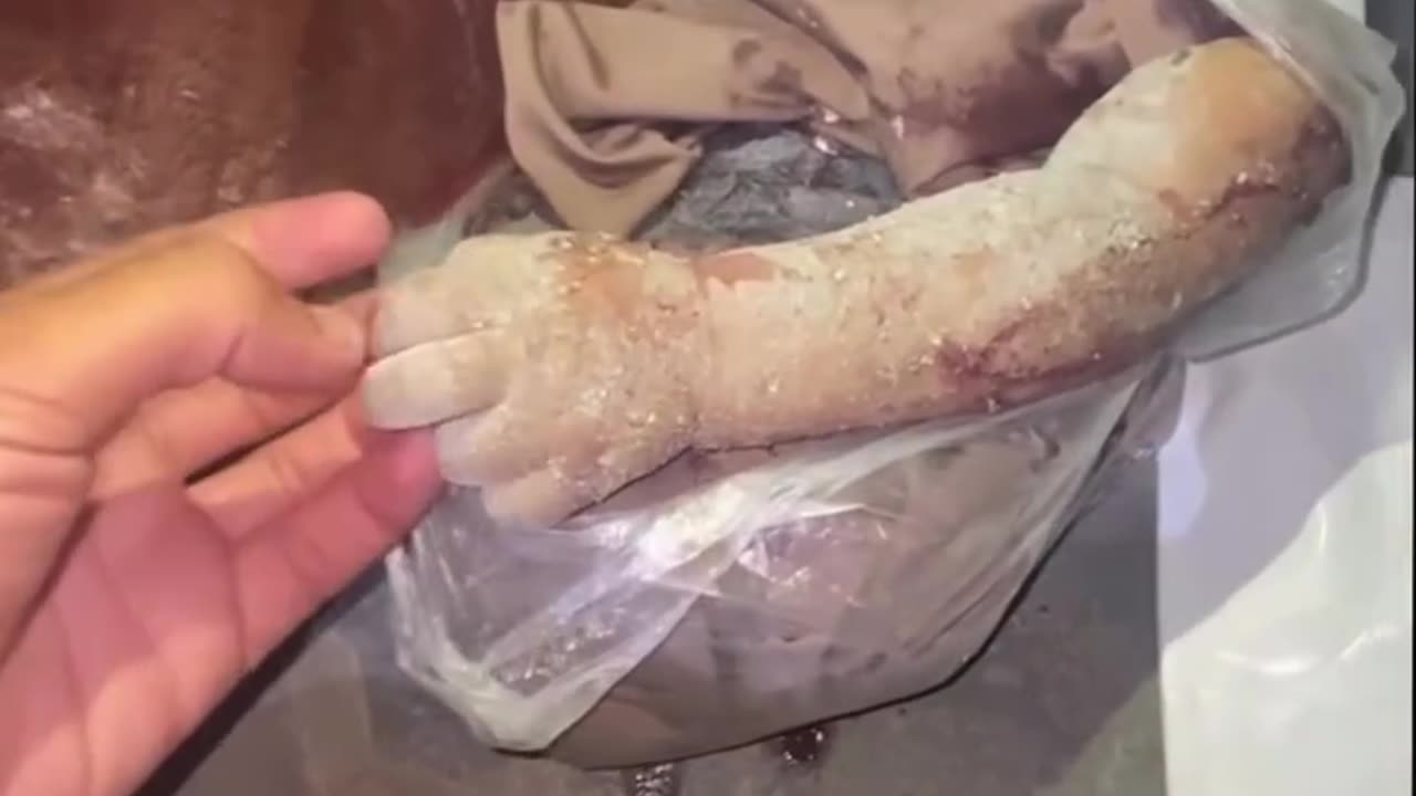 This is the hand of a child who arrived in pieces