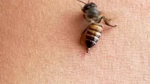 Bees bite us 🤕