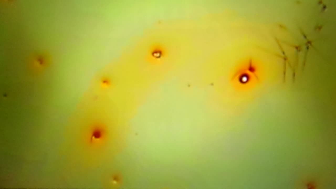 My blood cells 12 hours later 3/19/25: