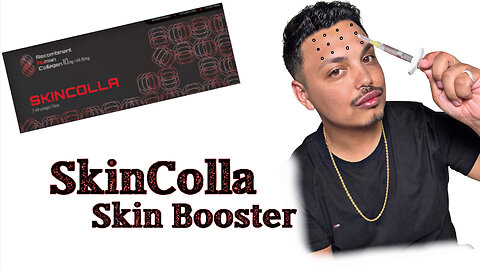 Join Me As I Meso Using Skincolla On My Forehead.