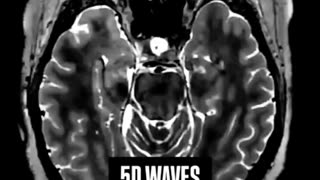 963 Hz, known as the 'frequency of God' ~ Listen for 1m at comfortable volume