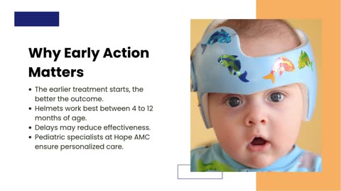 Plagiocephaly Helmets for Kids| Hope AMC| Leading Pediatric Therapist