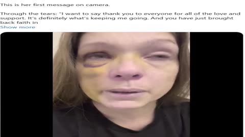 Woman Who Was Attacked By Black Mob For Breaking Up Fight Speaks