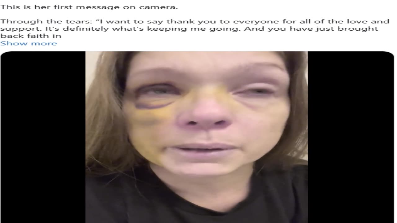 Woman Who Was Attacked By Black Mob For Breaking Up Fight Speaks