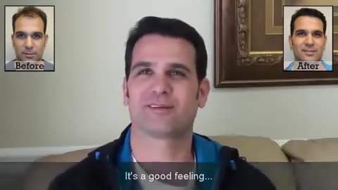 MaxHarvest™ Hair Transplant Surgery by Dr. Brett Bolton