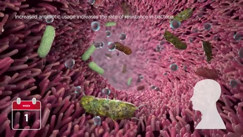Antibiotic resistance