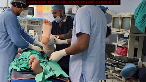 Varicose Veins Ablation in Low Cardiac EF