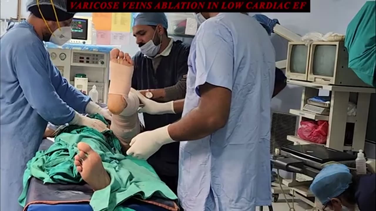 Varicose Veins Ablation in Low Cardiac EF