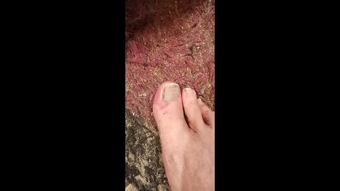 Toe of terry ouch