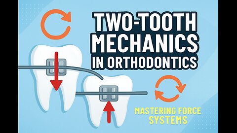 Two-Tooth Mechanics in Orthodontics: Mastering Force Systems & Burstone Geometry Classes