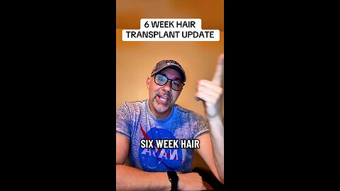 Hair Transplant Update