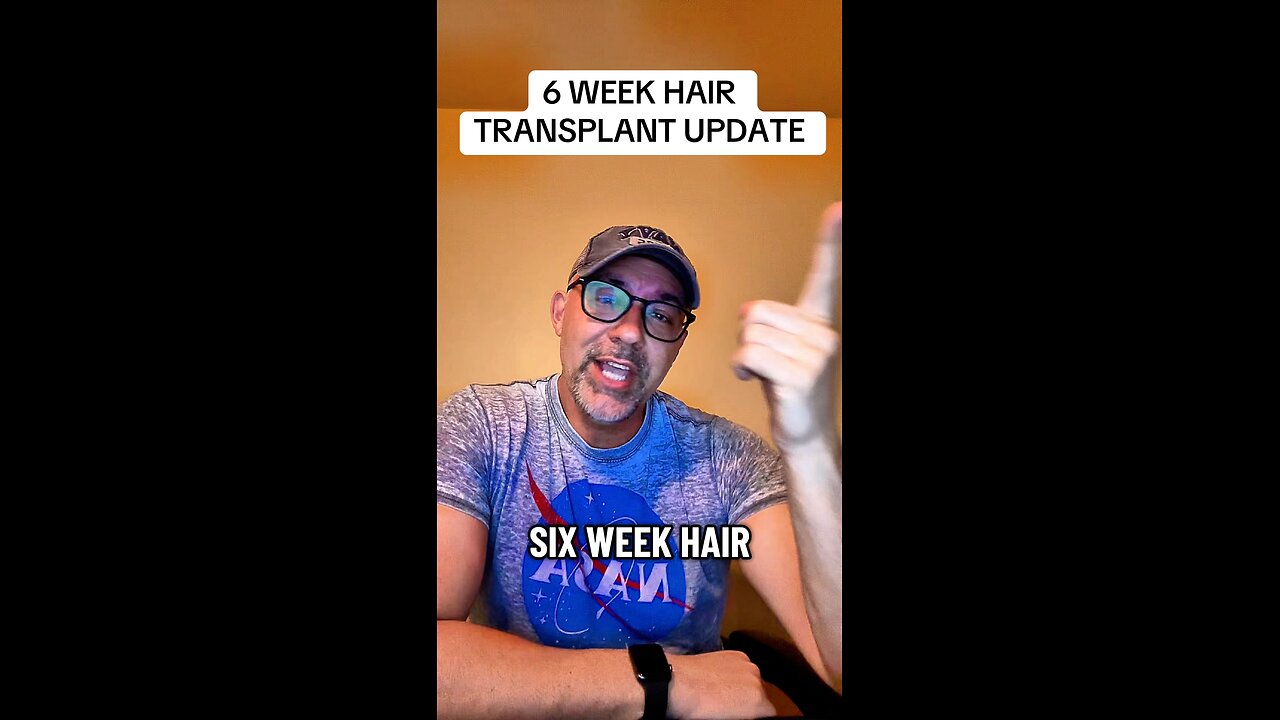 Hair Transplant Update