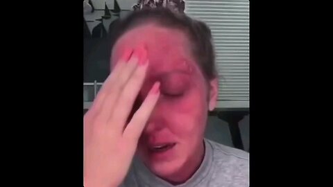 Vaccine Injury is common with shots