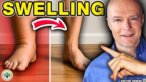 Absolutně nejlepší způsob, jak zmírnit otoky nohou a kotníků