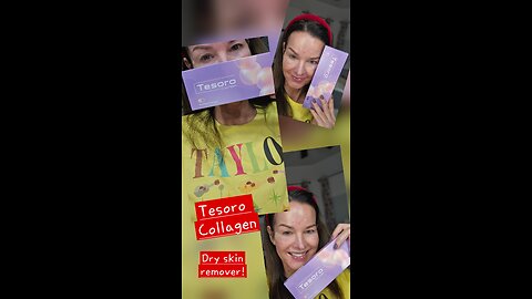 Tesoro Collagen used 2 syringes for my face but only did video of one