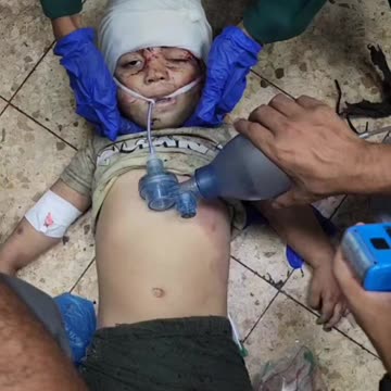 A child dies after being injured in an Israeli airstrike
