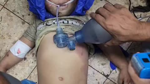 A child dies after being injured in an Israeli airstrike