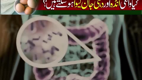 Stop Eating Eggs and Yogurt Together Until You Watch This @Dynamic Health with Dr. G.A #warning