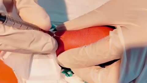 דר סטנלי פלוטקין אבי החיסונים קובע שאין קשר בין חיסון צהבת בי לתופעת לוואי של דלקת מוח בגלל העובדה שמעולם לא נעשו מחקרים על זה ואין מידע