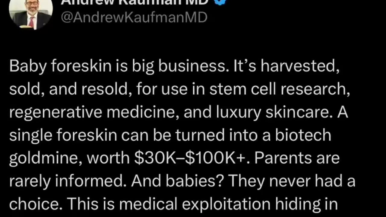 Andrew Kaufman MD.. Baby foreskin is big business It's harvested, sold & resold