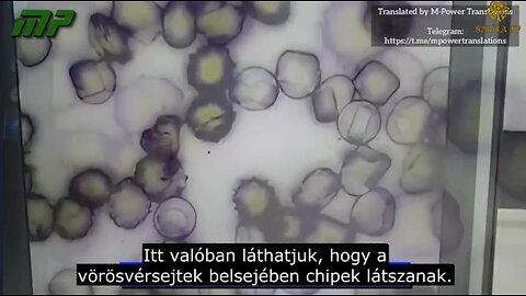 Oltás után Chip a vörösvérsejtek belsejében