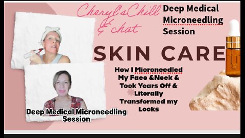 Deep Microneedling session For Glowing skin