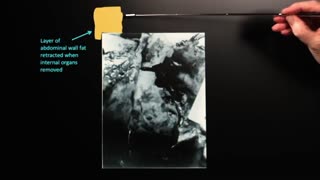 Doug Horne on Autopsy Photo Fox 8, the Mystery Photograph- w_Hofeling notes