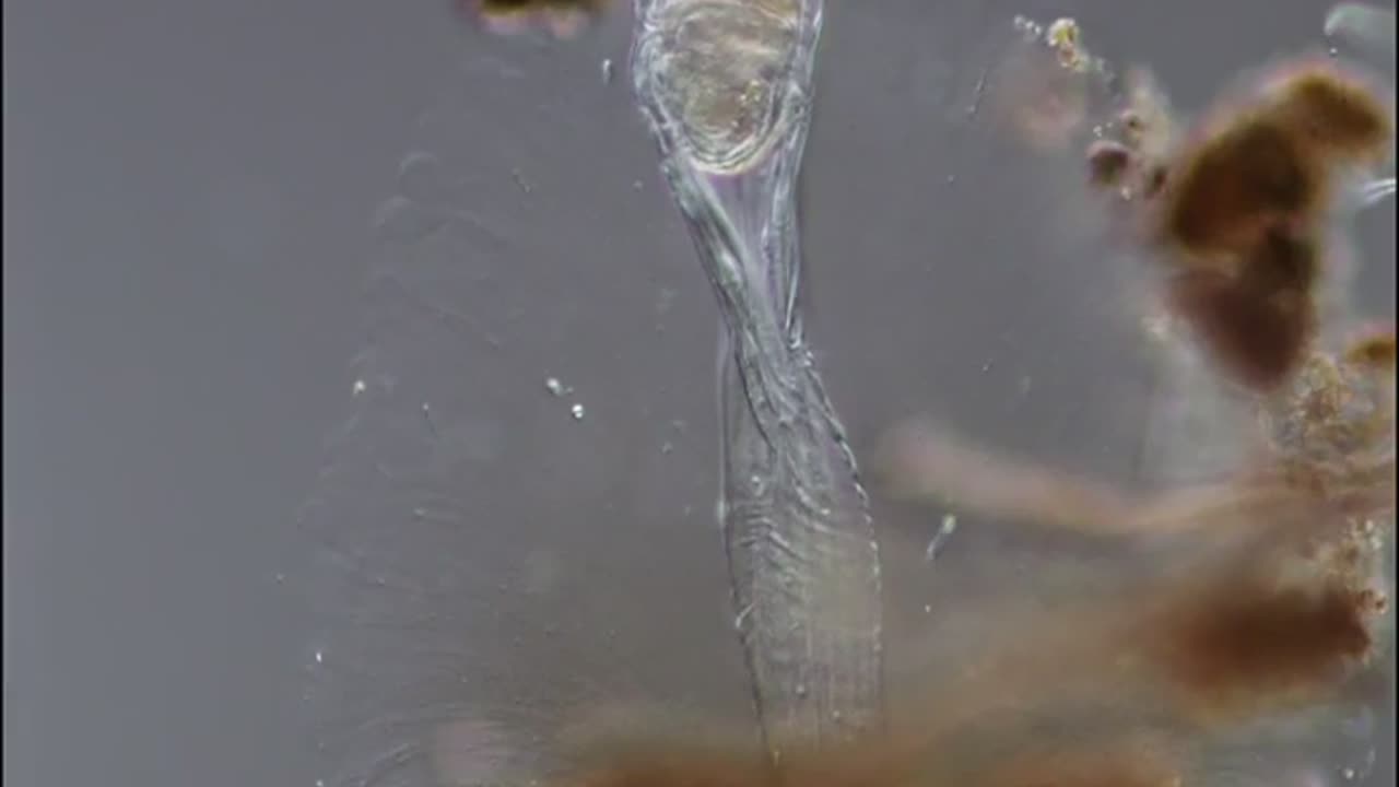 🤯✨ Microscopic View of Floscularia Melicerta’s Saw-Like Proboscis! | FeedMyCuriosity