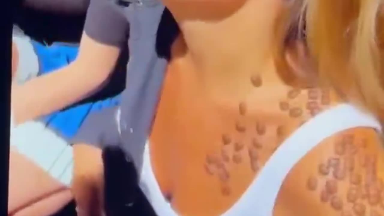 What kind of an infestation is this?? OMG😲