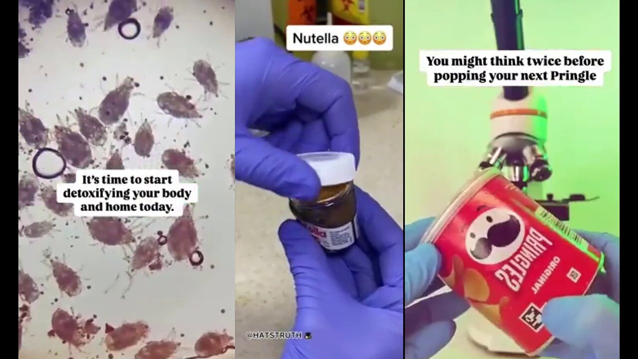 Popular Food Snacks Infested with Parasites
