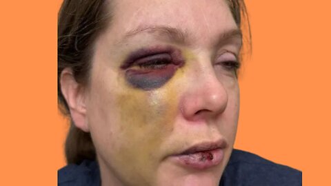 🏀 The Truth About The Cincinnati Brawl