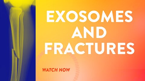 Exosomes and fractures