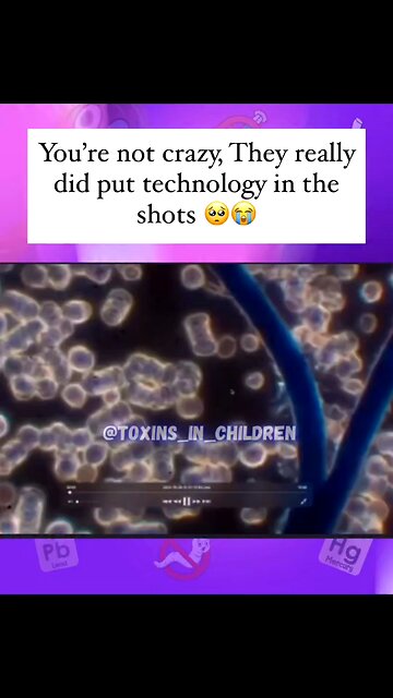 Technology in the Shots