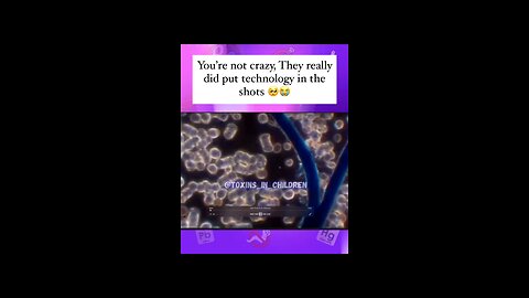 Technology in the Shots