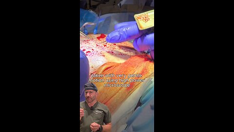 Getting a transplant is never too late!