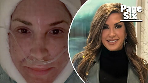 'RHONJ' alum Jacqueline Laurita posts jarring video after facelift and neck lift