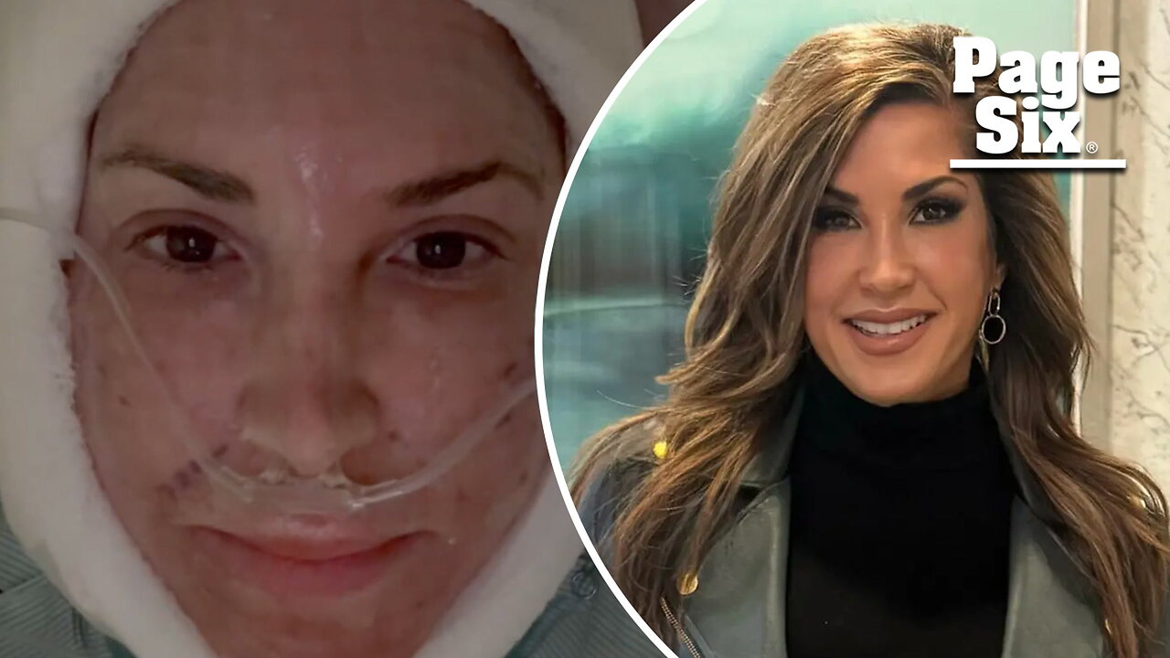 'RHONJ' alum Jacqueline Laurita posts jarring video after facelift and neck lift