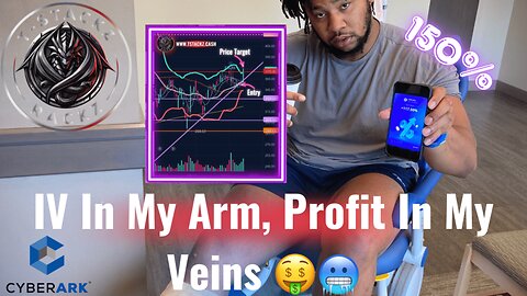 While You Were Clocking In… I Was Cashing Out! Surgery Profits 😴🛏️💉💵