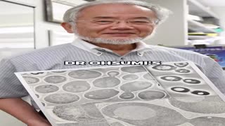 You Want Autophagy Fasting...Its Free Stem Cells