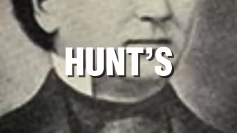 Safety Pin; A Tiny Wonder with a Big History